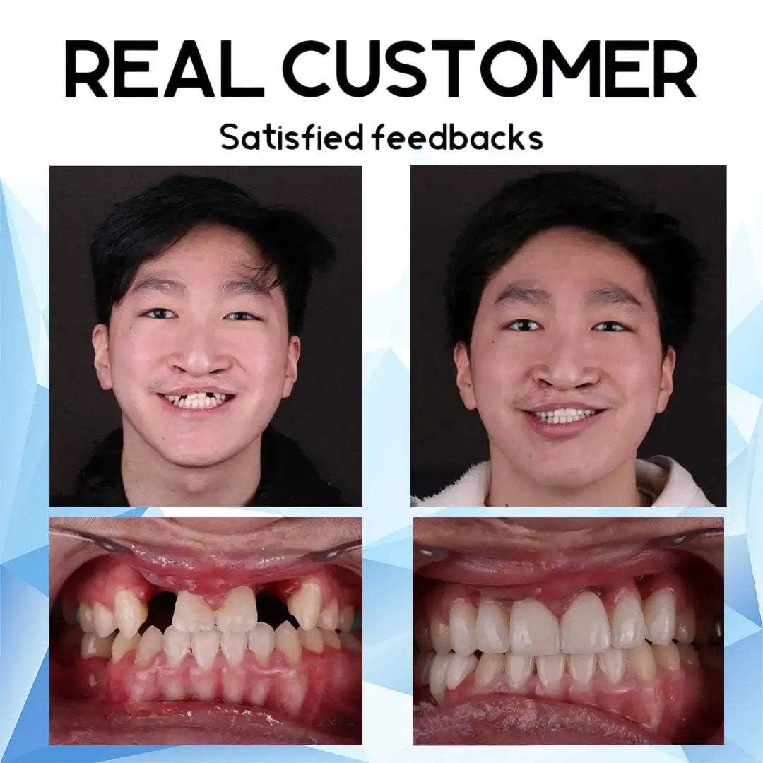 QlAWI-Premium CustomSilicone Denture Set DualCertification by theAmerican DentalAssociation(ADA)& theU.S. Food and DrugAdministration(FDA)