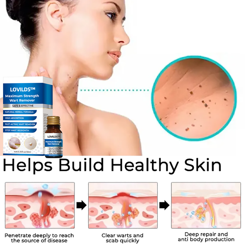 LOVILDS™ Maximum Strength Wart Remover