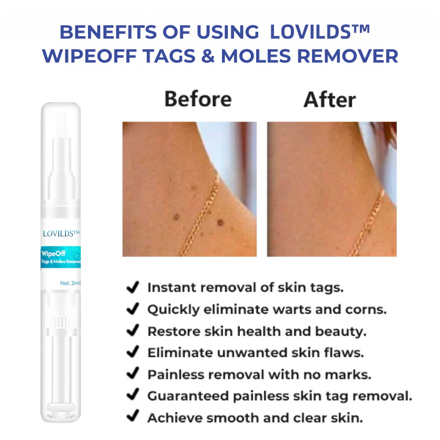 LOVILDS™ WipeOff Tags & Moles Remover