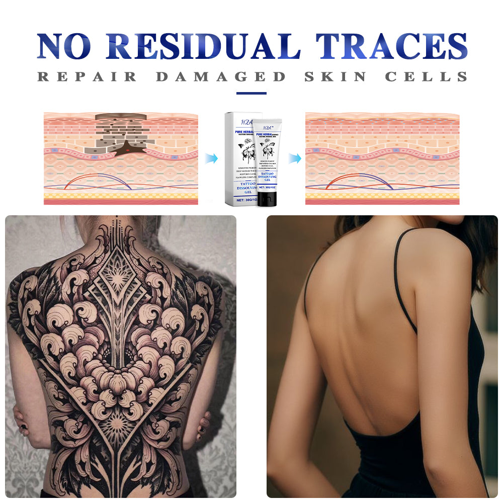 šLimited time discount sale š„- HZA⢠Tattoo Dissolving Gel