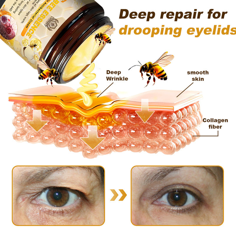 LOVILDS™ Bee Essence Skin Antibacterial Cream—used to treat a variety of skin diseases (AAD recommended).