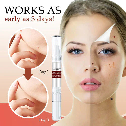 🍒BUY 1 GET 1 FREE🍒LOVILDS™ Tags & Moles Remover