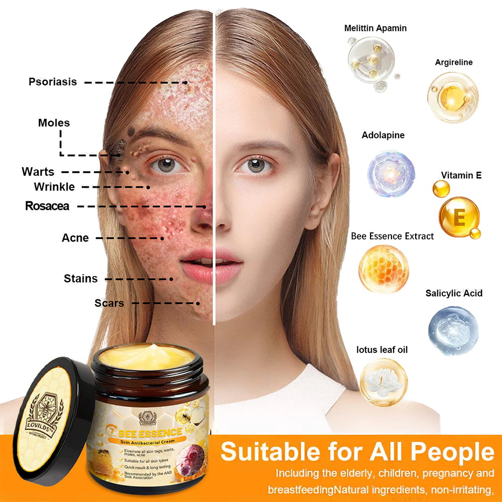 LOVILDS™ Bee Essence Skin Antibacterial Cream—used to treat a variety of skin diseases (AAD recommended).