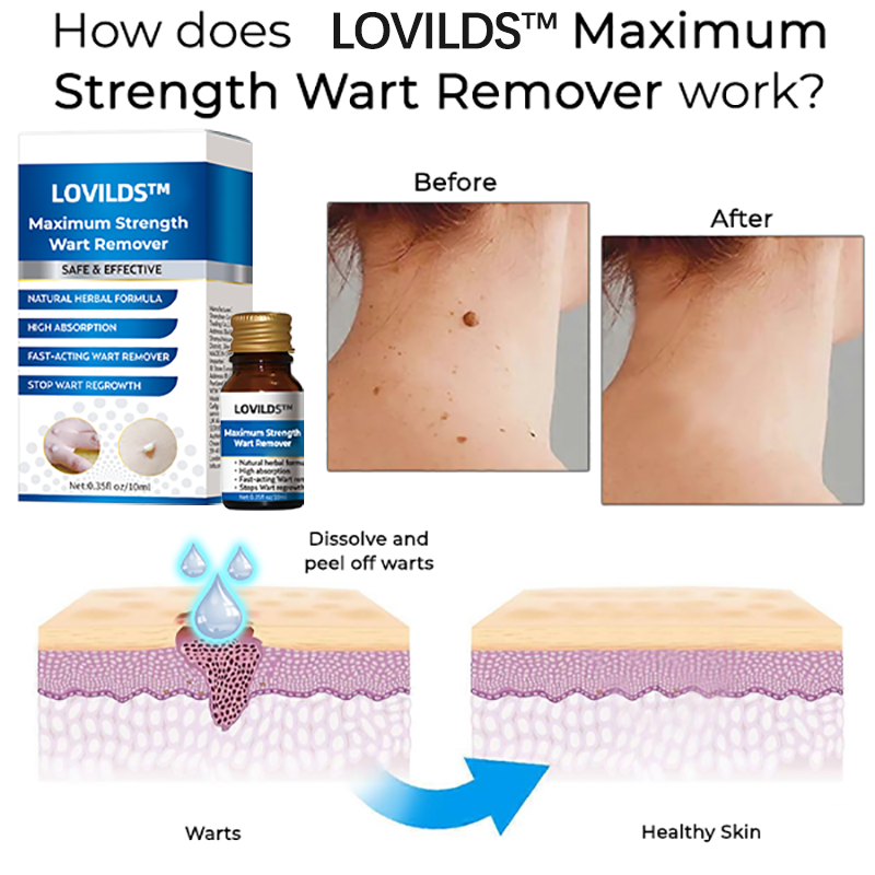 LOVILDS™ Maximum Strength Wart Remover