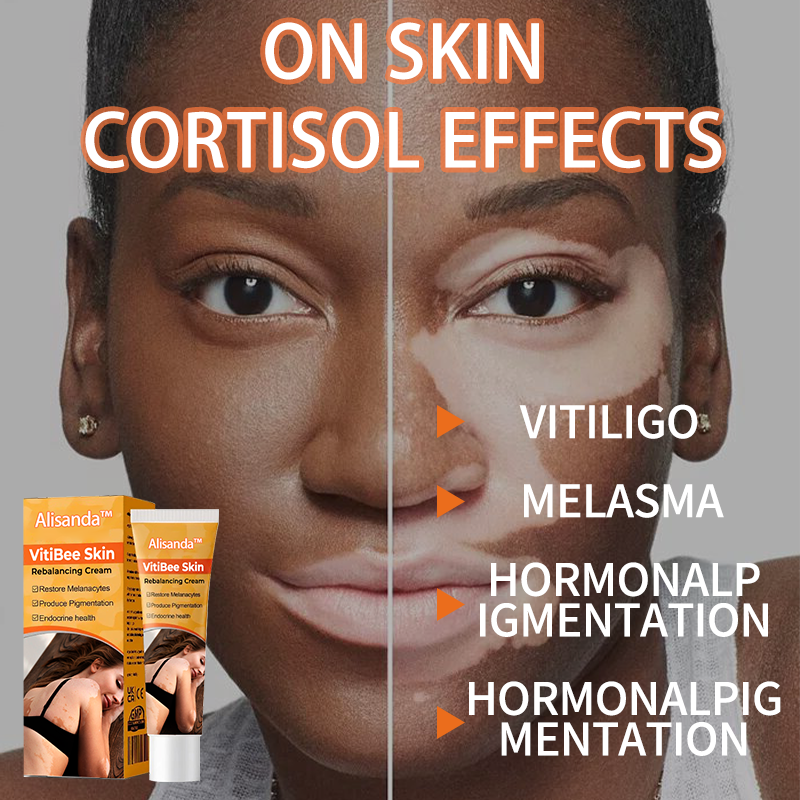 Alisanda™VitiBee Skin Rebalancing Cream US Dermatologist Approved