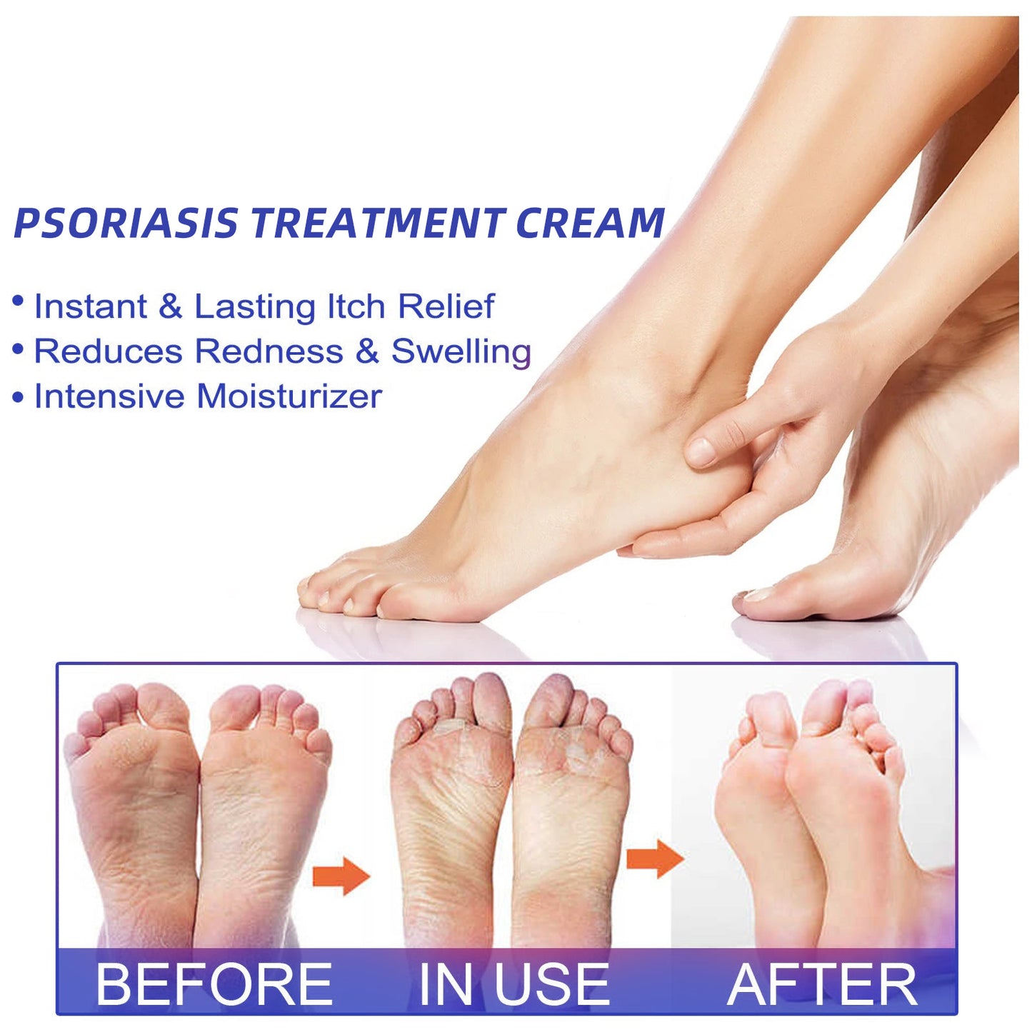 ļ¼š„Buy 2 Get 1 Freeš„ļ¼LOVILDSā¢Herbal Psoriasis Treatment Cream