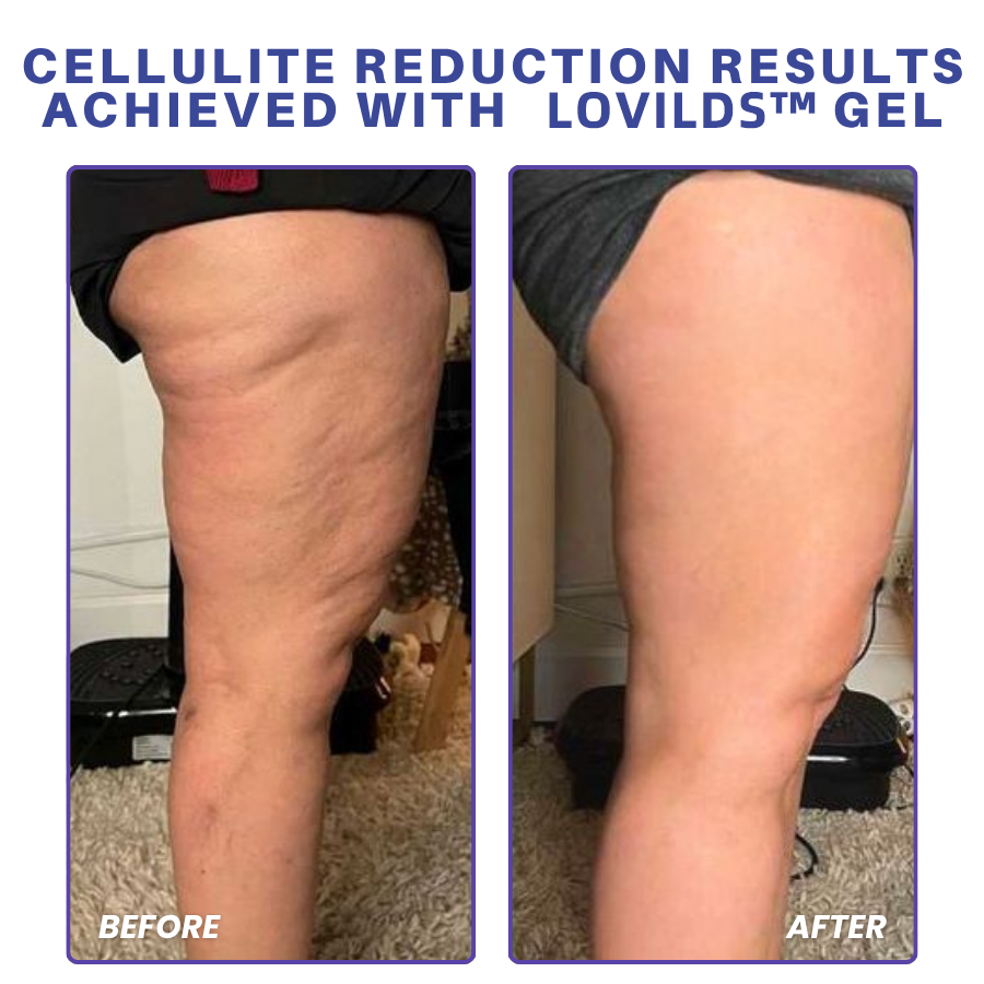LOVILDS™ PDRN-GLP-1 Cellulite Targeting Reedle Shot Gel