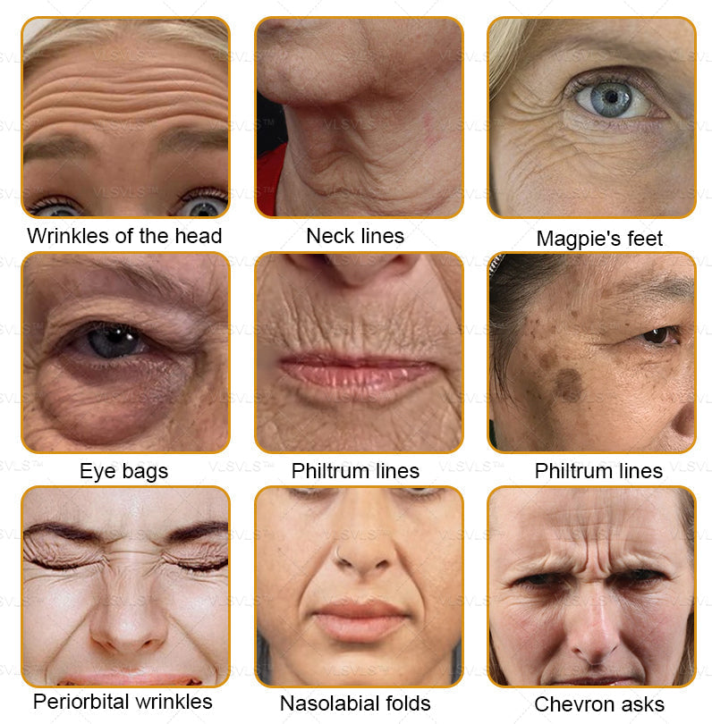 LOVILDS™ Bee Essence Skin Antibacterial Cream—used to treat a variety of skin diseases (AAD recommended).