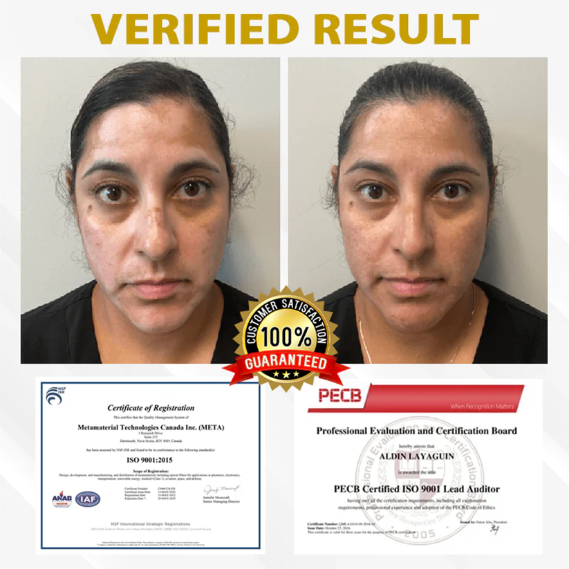 Alisanda™VitiBee Skin Rebalancing Cream US Dermatologist Approved