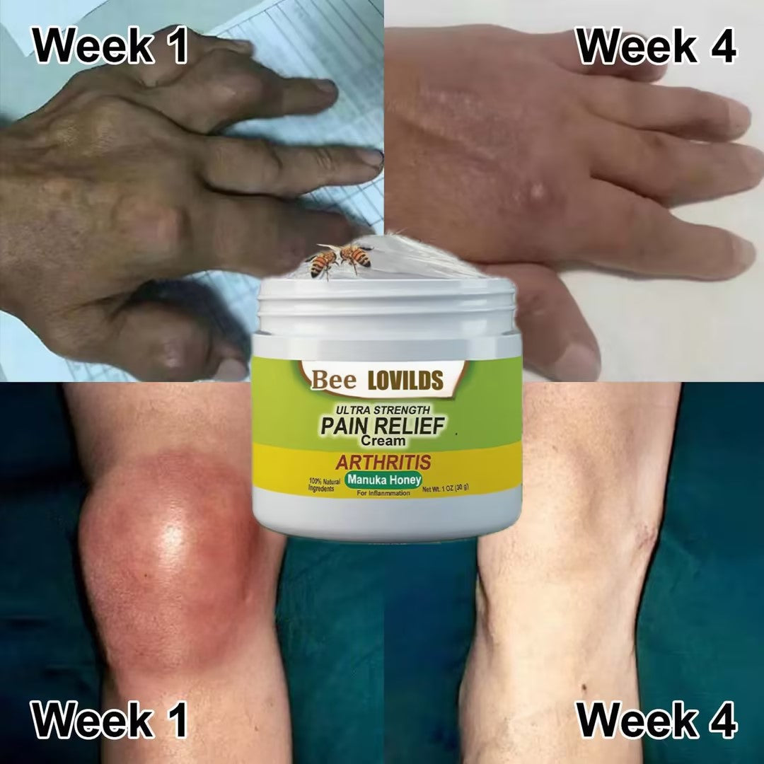 【Official Brand Store】 New Zealand Bee-Infused Joint and Bone Therapy Advanced Cream