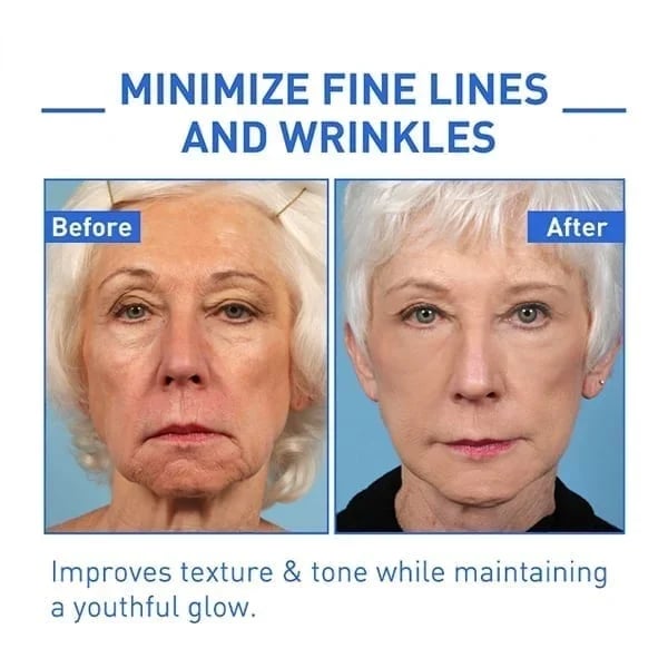✨Last Day Promotion 70% OFF - ✨Botulinum Serum🔥