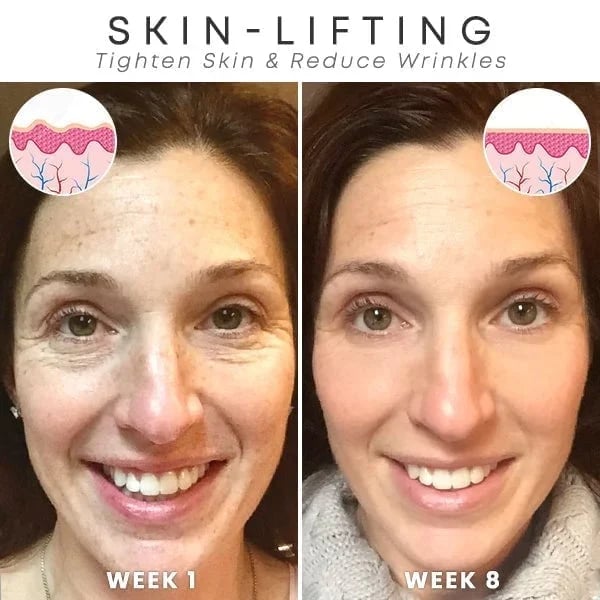 ✨Last Day Promotion 70% OFF - ✨Botulinum Serum🔥