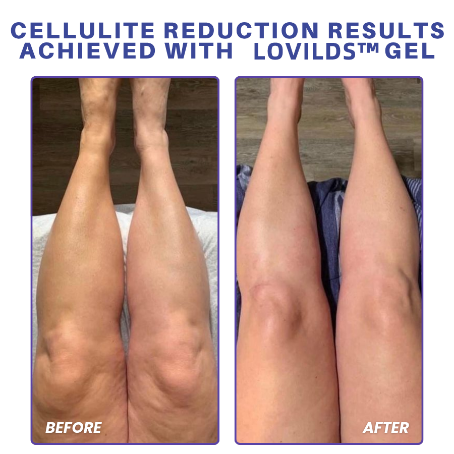 LOVILDS™ PDRN-GLP-1 Cellulite Targeting Reedle Shot Gel