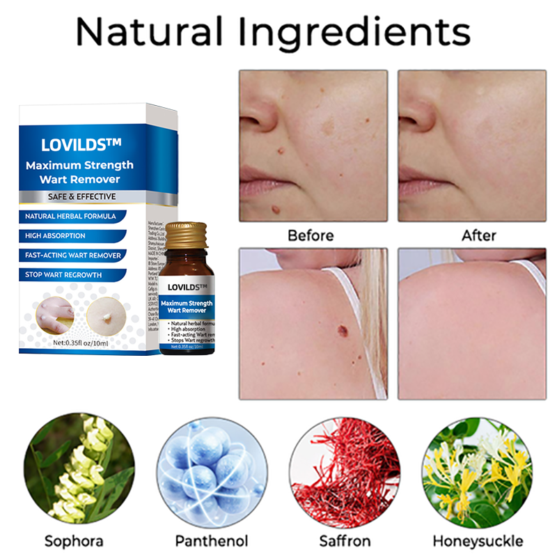 LOVILDS™ Maximum Strength Wart Remover