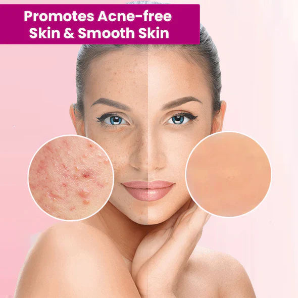 🍒BUY 1 GET 1 FREE🍒LOVILDS™ Tags & Moles Remover