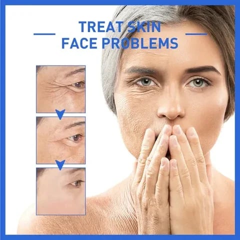 ✨Last Day Promotion 70% OFF - ✨Botulinum Serum🔥