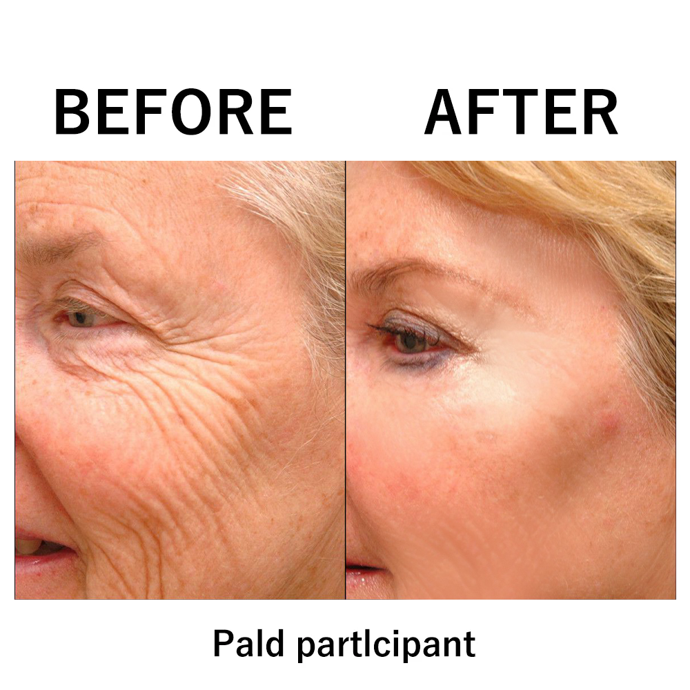 (🖤Black Friday & Christmas Double Event🎄-50%off)Replace new packing-Instant Face Tightener ✨