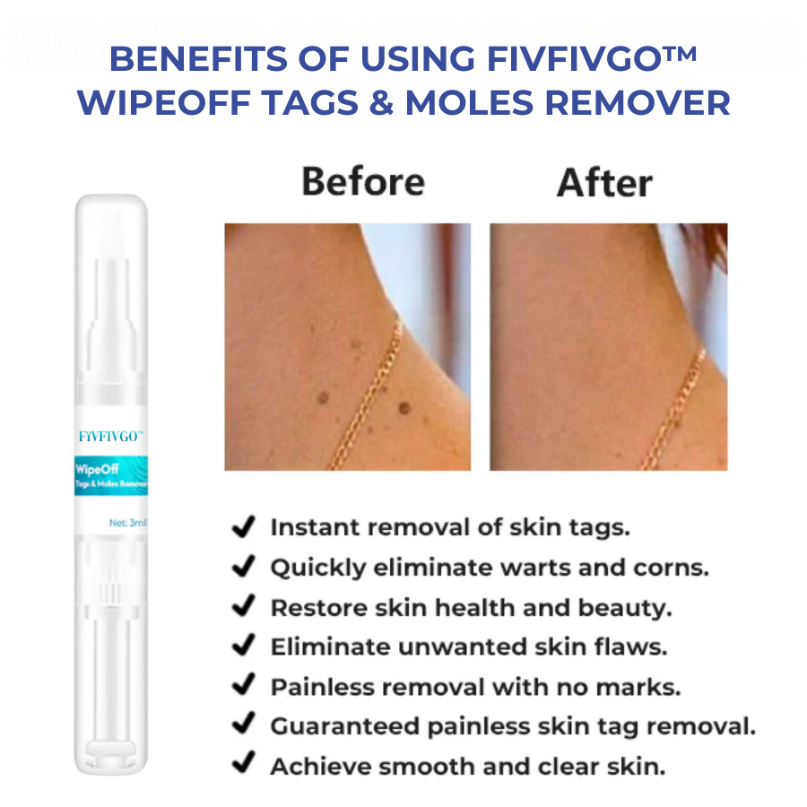 LOVILDS™ WipeOff Tags & Moles Remover