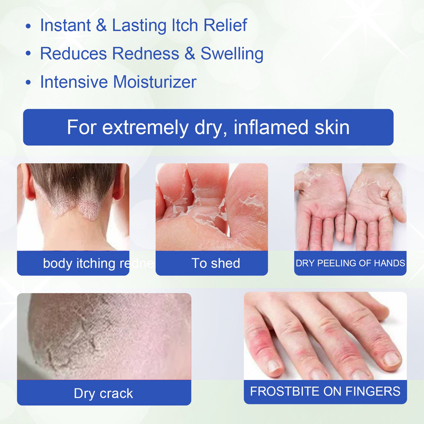 ļ¼š„Buy 2 Get 1 Freeš„ļ¼LOVILDSā¢Herbal Psoriasis Treatment Cream