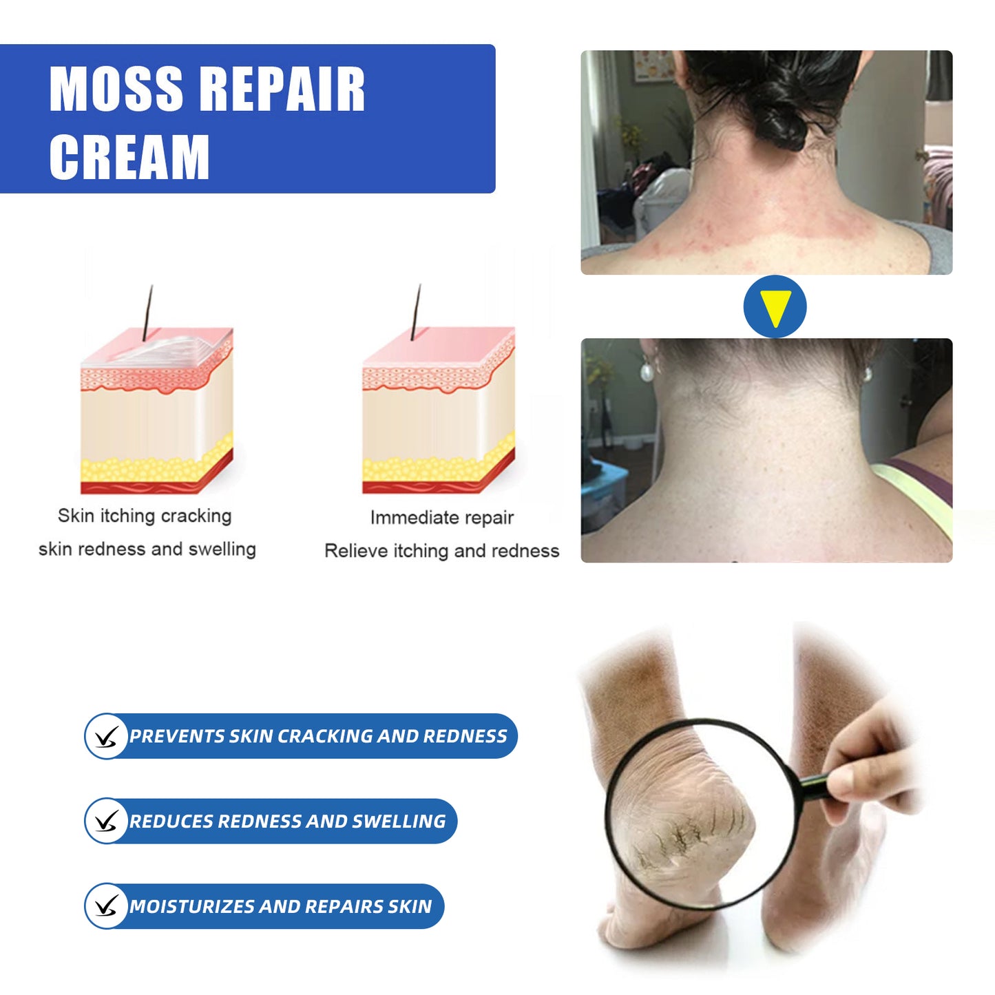 ļ¼š„Buy 2 Get 1 Freeš„ļ¼LOVILDSā¢Herbal Psoriasis Treatment Cream