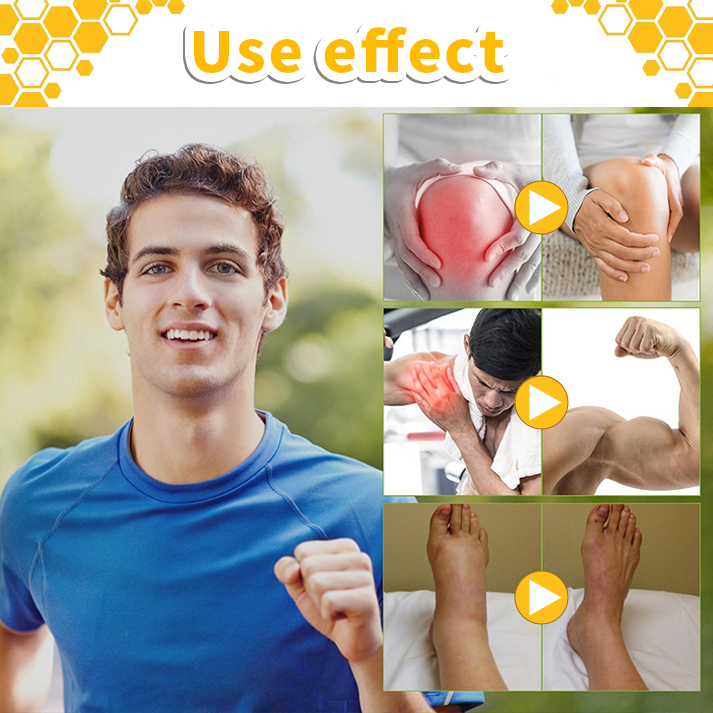 🐝🐝Bee Poison Health Cream