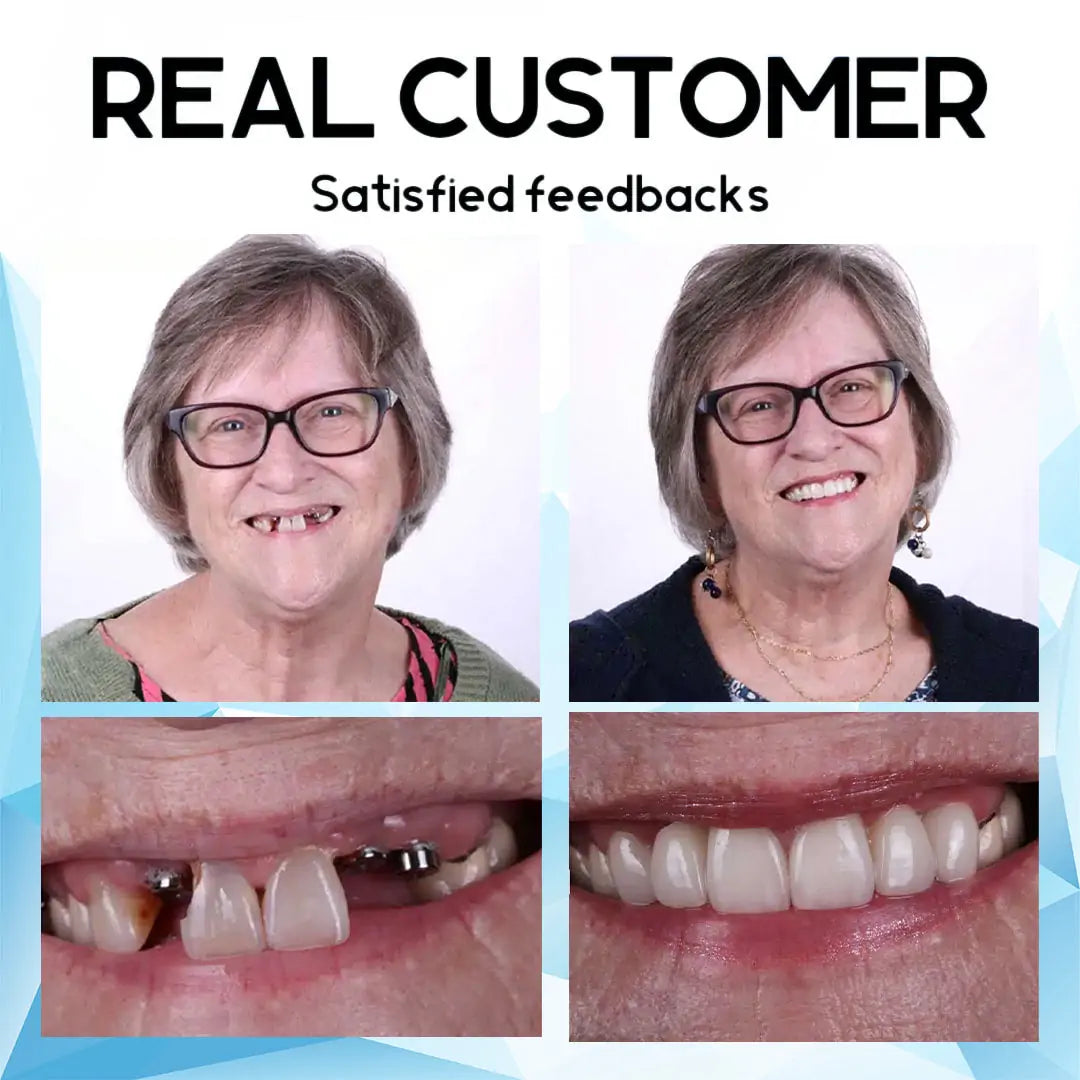 QlAWI-Premium CustomSilicone Denture Set DualCertification by theAmerican DentalAssociation(ADA)& theU.S. Food and DrugAdministration(FDA)