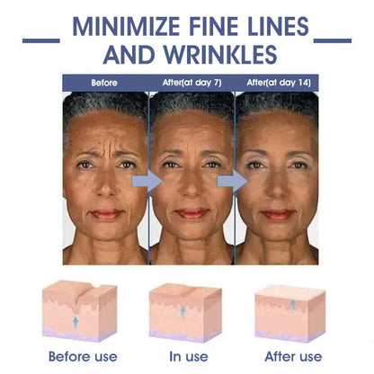✨🩵𝐋𝐚𝐬𝐭 𝐃𝐚𝐲 𝐃𝐢𝐬𝐜𝐨𝐮𝐧𝐭: 87% 𝐎𝐅𝐅🌸LOVILDS® 𝐀𝐝𝐯𝐚𝐧𝐜𝐞𝐝 𝐅𝐢𝐫𝐦𝐢𝐧𝐠 & 𝐖𝐫𝐢𝐧𝐤𝐥𝐞-𝐑𝐞𝐝𝐮𝐜𝐢𝐧𝐠 𝐂𝐫𝐞𝐚𝐦: Restore Skin Elasticity⭐