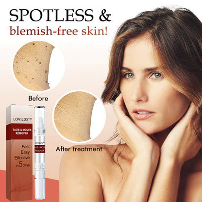 🍒BUY 1 GET 1 FREE🍒LOVILDS™ Tags & Moles Remover