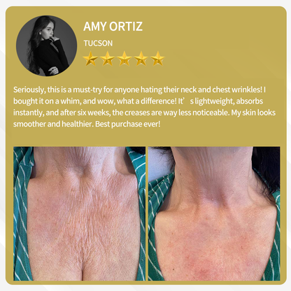 LOVILDS™ Bee Poison Multi care cream  (👨‍⚕️AAD Recommended)