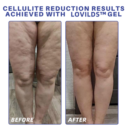 LOVILDS™ PDRN-GLP-1 Cellulite Targeting Reedle Shot Gel
