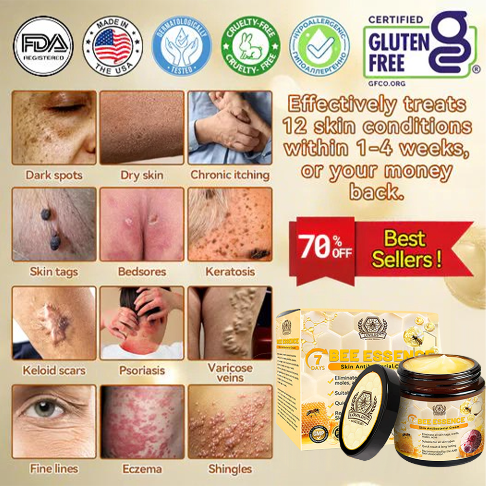 LOVILDS™ Bee Essence Skin Antibacterial Cream—used to treat a variety of skin diseases (AAD recommended).