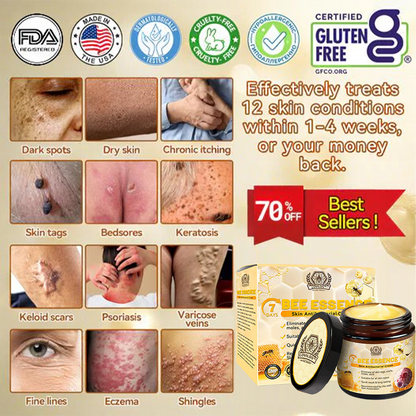 LOVILDS™ Bee Essence Skin Antibacterial Cream—used to treat a variety of skin diseases (AAD recommended).