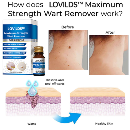 LOVILDS™ Maximum Strength Wart Remover