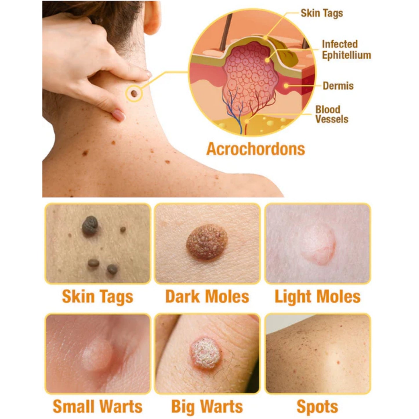 🐝LOVILDS™ TagRecede Bee  Poison Treatment Spray