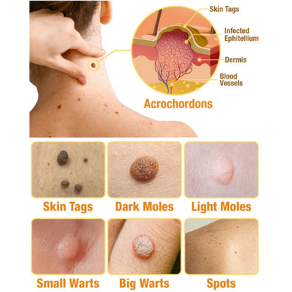 🐝LOVILDS™ TagRecede Bee  Poison Treatment Spray