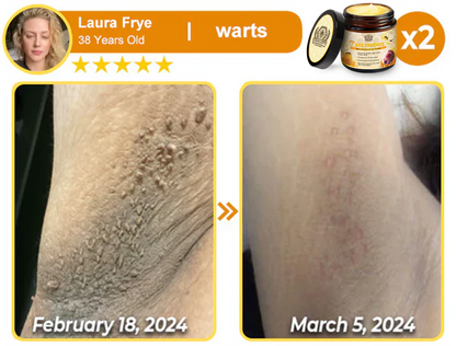 LOVILDS™ Bee Essence Skin Antibacterial Cream—used to treat a variety of skin diseases (AAD recommended).