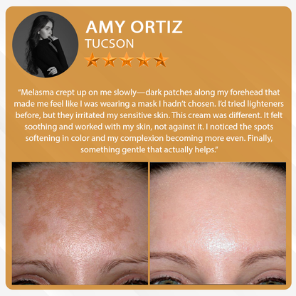 LOVILDS™ Bee Poison Multi care cream  (👨‍⚕️AAD Recommended)
