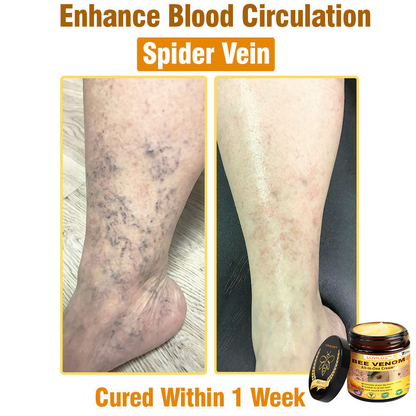 LOVILDS™ Bee Venom All-in-One Cream 👩‍⚕️US Dermatologist Approved