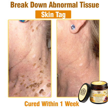 LOVILDS™ Bee Essence Skin Antibacterial Cream—used to treat a variety of skin diseases (AAD recommended).