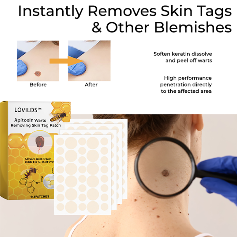 LOVILDS™ Apitoxin Warts Removing Skin Tag Patch