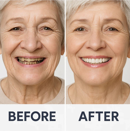 Custom-SET Functional Dentures