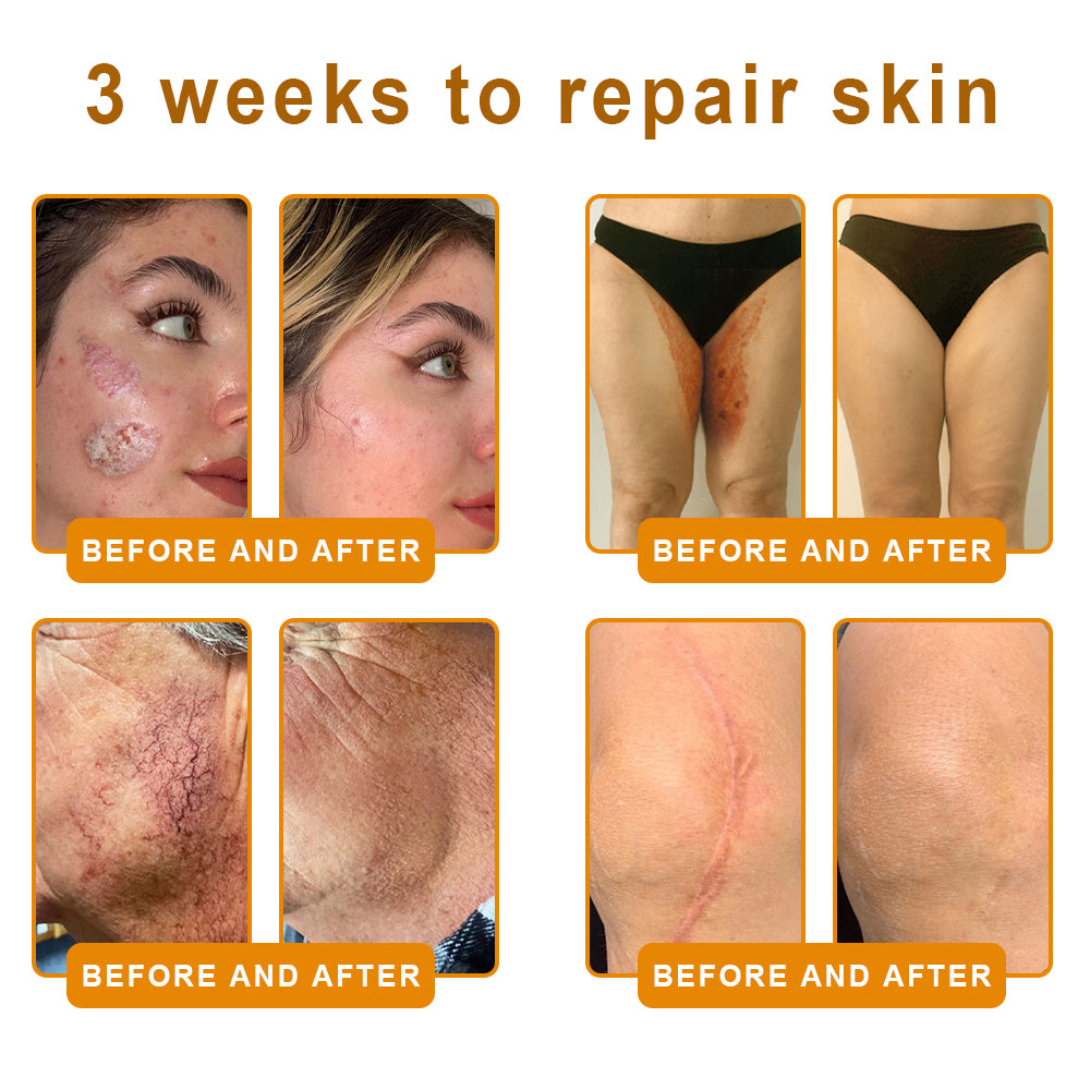 LOVILDS™  Bee Poison Skin Restoration Cream 👨‍⚕️（🔥LAST DAY SALE-80% OFF)🥇👩‍⚕️