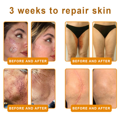 LOVILDS™  Bee Poison Skin Restoration Cream 👨‍⚕️（🔥LAST DAY SALE-80% OFF)🥇👩‍⚕️