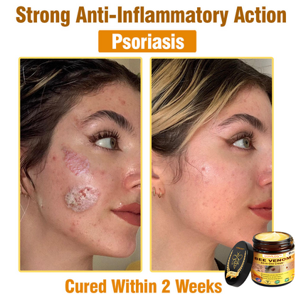 LOVILDS™ Bee Venom All-in-One Cream 👩‍⚕️US Dermatologist Approved