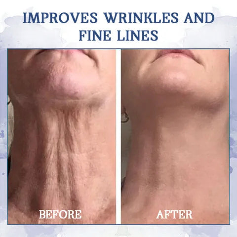 ✨🩵𝐋𝐚𝐬𝐭 𝐃𝐚𝐲 𝐃𝐢𝐬𝐜𝐨𝐮𝐧𝐭: 87% 𝐎𝐅𝐅🌸LOVILDS® 𝐀𝐝𝐯𝐚𝐧𝐜𝐞𝐝 𝐅𝐢𝐫𝐦𝐢𝐧𝐠 & 𝐖𝐫𝐢𝐧𝐤𝐥𝐞-𝐑𝐞𝐝𝐮𝐜𝐢𝐧𝐠 𝐂𝐫𝐞𝐚𝐦: Restore Skin Elasticity⭐