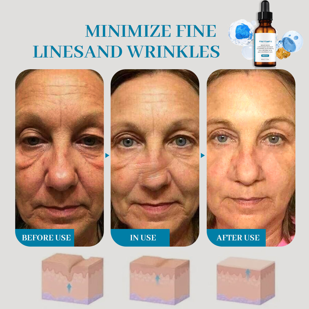 ✨Best Vitamin C alert!!🔥Best Vitamin C SERUM!!