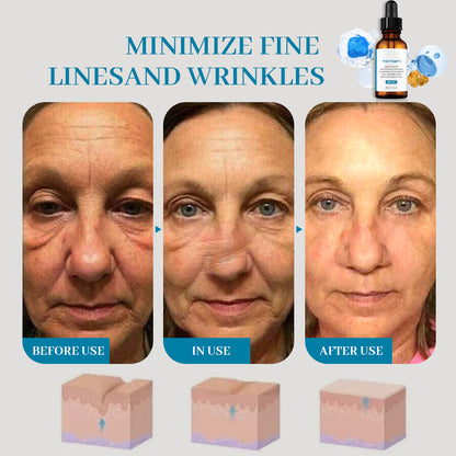 ✨Best Vitamin C alert!!🔥Best Vitamin C SERUM!!