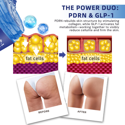 LOVILDS™ PDRN-GLP-1 Cellulite Targeting Reedle Shot Gel