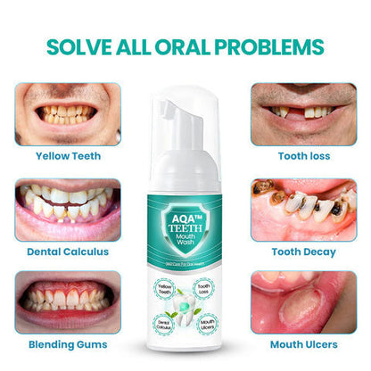 🔥 LAST DAY SALE 70% OFF 🔥AQA™ NEW TEETH Mouthwash - Solve all Oral Problems