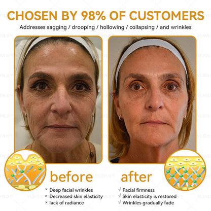 LOVILDS™ Bee Essence Skin Antibacterial Cream—used to treat a variety of skin diseases (AAD recommended).